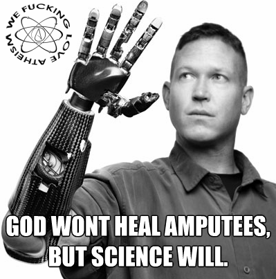 God wont help amputees because god doesn't exist. 